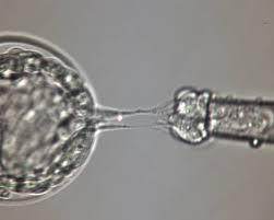 Polar body ler embriyonun ileri gelişiminde işlevsiz olduğundan bu hücrelerin biyopsisinden embriyo etkilenmez Tüm PGD endikasyonlarına uygulanabilir Maternal ve paternal genetik bozukluklar test