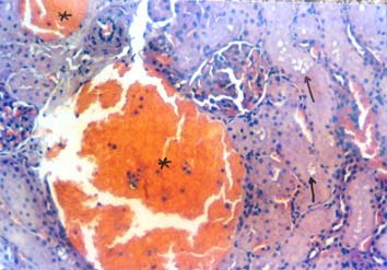Histology-Embryology Kara et al ekil 5. Kadmiyum klorür uygulanıının 7. günü. Tübüller arası kan damarlarında genileme ve konjesyon (*), proksimal tübüllerde vakuolizasyon (ok) izlenmekte.