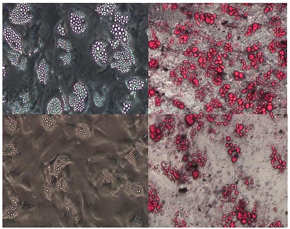 Sekil 4.1. Adipojenik farklılaşma deneyine ait mikroskop görüntüleri.