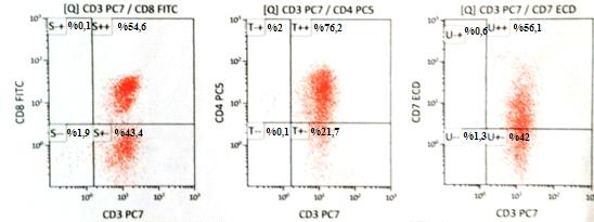 Şekil 4.3. Mononükleer hücrelerden izole edilen blastik T hücrelerin flow sitometrik analiz grafikleri.