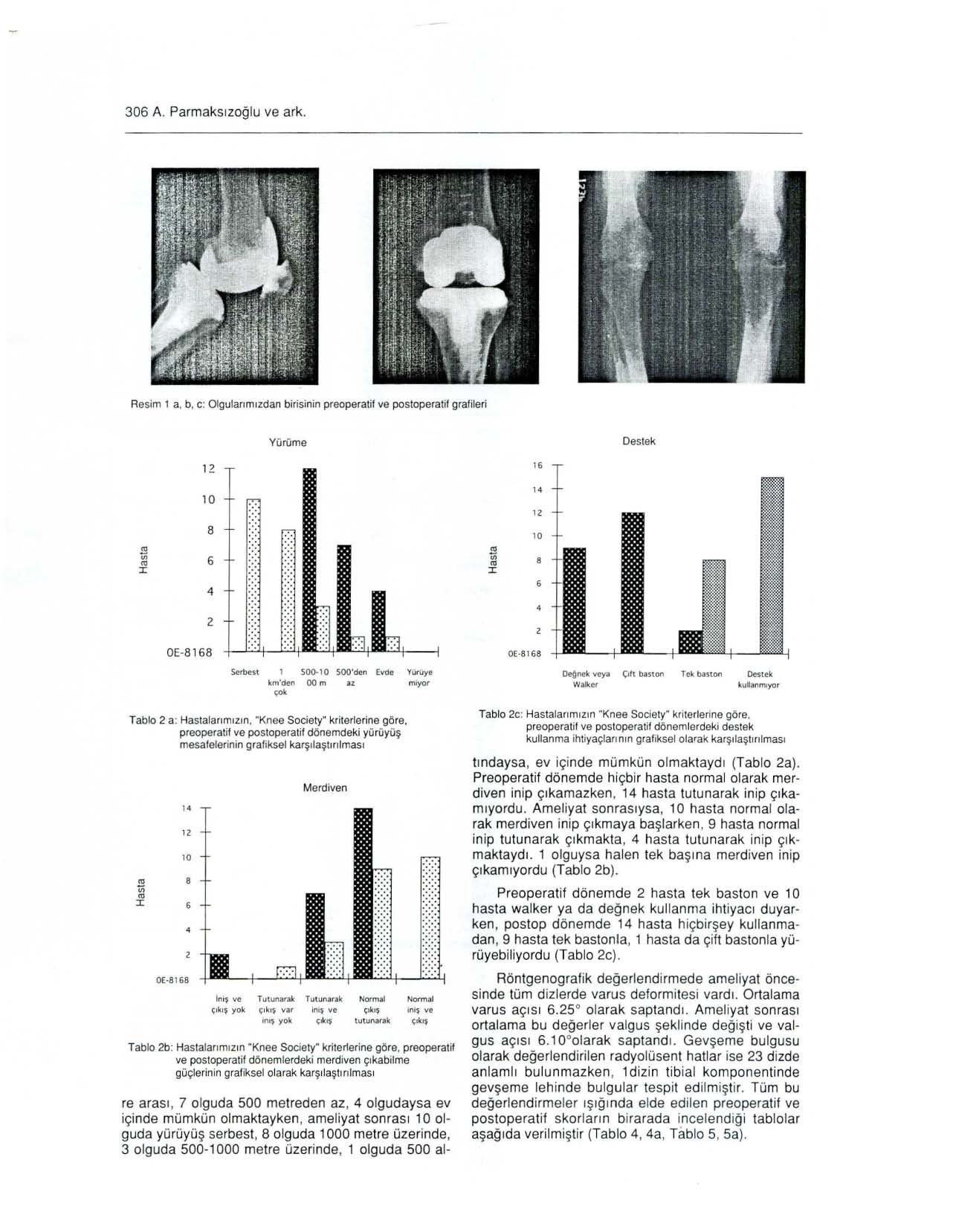 306 A. Parm a k sızoğl u ve ark. Resim 1 a, b, c: O lg u la rımı zda n birisi nin preoperatif ve postaperatif grafileri Yürüme Destek 1Z 16 LO '0 14 12."l ~ :ı: '" 8 - f7: 6 4-2 7: 10 OE-8168 "'-'.