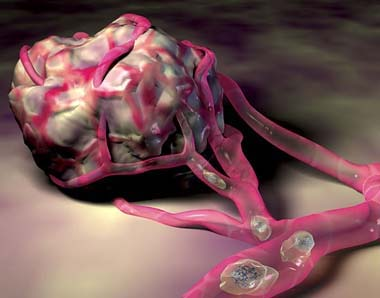 Şekil 2.1: Tümör hücrelerinin yayılabilecekleri kapiller ağa tutunması Akciğere lenfatik yolla da tümör yayılımı olabilir.