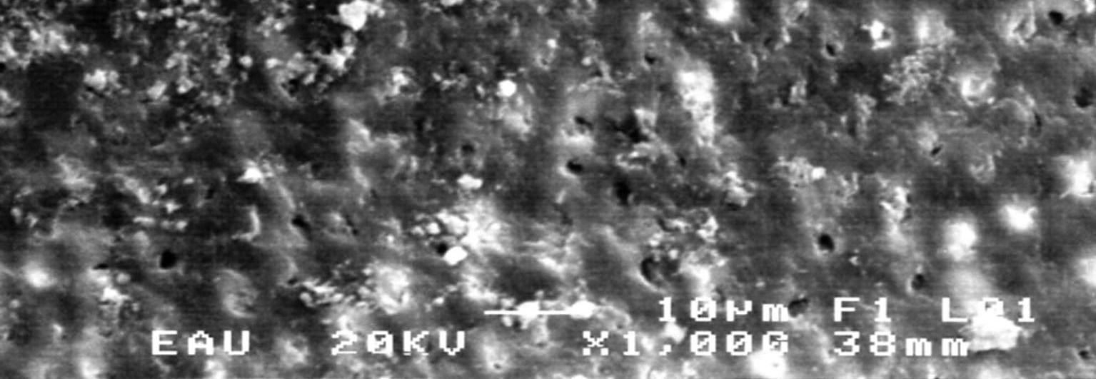 113 Şekil 31: Geleneksel el aletleri ile şekillendirme ve NaOCl ve serum fizyolojik kombinasyonu ile irrigasyon yapılan gruptan elde edilen bir fotoğrafta smear tabakasının görünümü Tüm gruplar