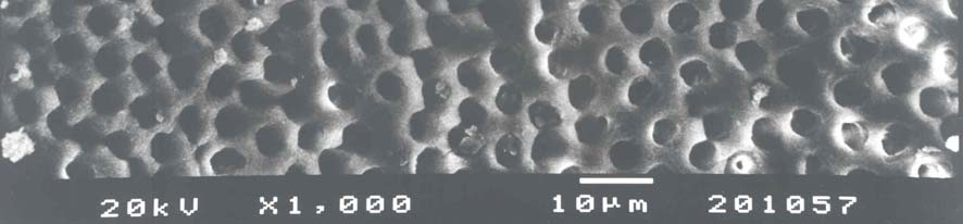 Resim30: EGTA + NaOCl orta 1/3