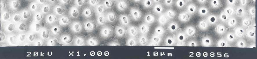 Resim48: CDTA+NaOCl orta 1/3