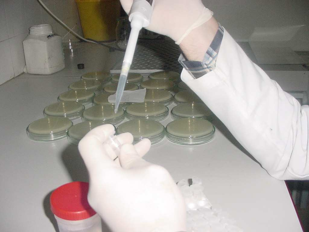 Resim 15: Ependorf tüp içine toplanan dentin talaş örneği 3. Talaş örnekleri 2 saat içinde mikrobiyoloji laboratuvarına ulaştırılıp mikrobiyolojik testlere başlandı. 4.