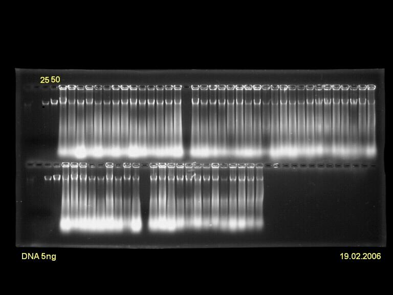 3. MATERYAL VE METOD Mehmet Ali ÜNVERDİ DNA konsantrasyonlarının belirlenmesi aşağıda açıklanan protoköle göre yapılmıştır: İzole edilmiş olan DNA örneğinden alınan 2 µl DNA 1.