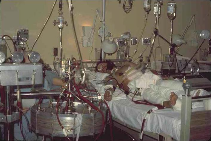 İlk başarılı ECMO hastası, 1971 J Donald Hill MD and Maury