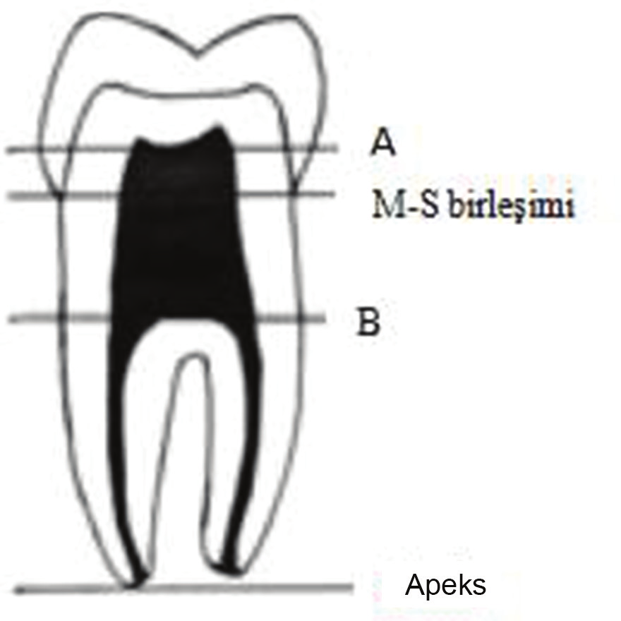 sement birleşim yeri daha geniş olarak belirlediği dişler değerlendirmeye alındı (Resim 1). Ölçümler Shifman ve Chanannel tarafından geliştirilen taurodont indeks e göre yapıldı (Şekil 1).