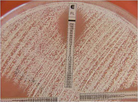 µg/ml). C. albicans izolatlarında flukonazol direnci %4.3 ve non-albicans Candida izolatlarında %16.6 idi. Amfoterisin B 1 µg/ml konsantrasyonda izolatların %97.