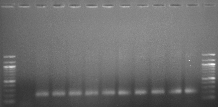 Şekil 4.39 Kaskat besleme için PCR1 kademesinden sonraki elektroforez1 görüntüsü Şekil 4.