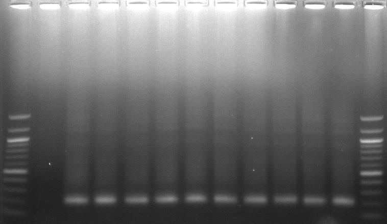 kademeli PCR (PCR1 ve PCR2) uygulanarak elde edilen ürünlere DGGE uygulaması yapılmıştır. PCR1 ve PCR2 işlemlerinden sonra sonra gerçekleştirilen elektroforez1 (Şekil 4.15) ve elektorofrez2 (Şekil 4.