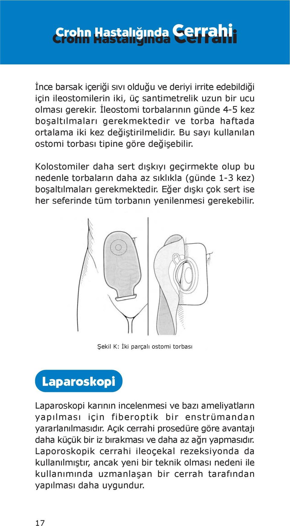 Kolostomiler daha sert dışkıyı geçirmekte olup bu nedenle torbaların daha az sıklıkla (günde 13 kez) boşaltılmaları gerekmektedir.