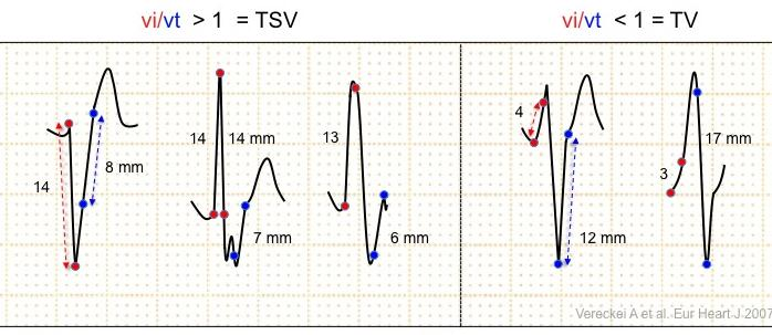 vi/vt<1