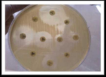 Şekil 2. 3. Escherichiacoli kökenlerinin disk difüzyon yöntemi ile yapılan duyarlılık testi görüntüleri 2.4.2. Çift Disk Sinerji Yöntemi Bu yöntemde 0.