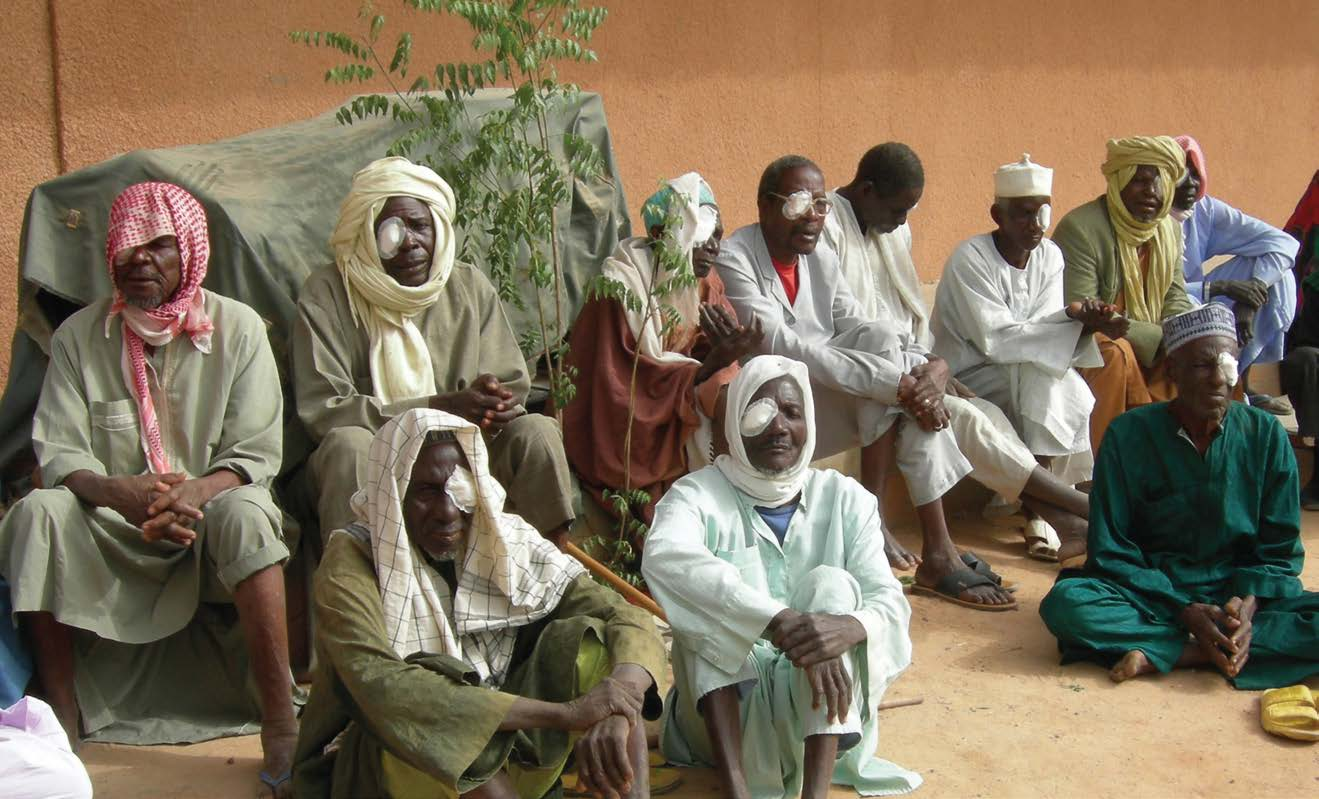 40 41 GÖZ NURU Yeryüzü Doktorları 2006 yılından beri belli aralıklarla başta Nijer ve Kenya olmak üzere ihtiyaç duyulan yerlerde öncelik katarakt ameliyatlarına verilmek üzere göz hastalıkları