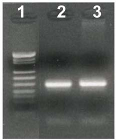 Fig. 2: Nested amplifikasyon ürünlerinin %3 agaroz jel elektroforezi ile görüntülenmesi. Fig. 1: