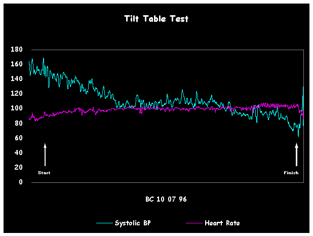 Tilt-Table Testi: