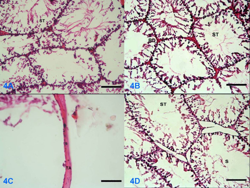 Şekil 2. Düşük Doz. 2A. Testisin genel histolojik yapısı;st: Seminifer tübül, BD: Bağ doku, H&E X 10 Bar: 500µm. 2B Seminifer tübüllerin görünümü; H&E X 20 Bar: 250µm 2C.