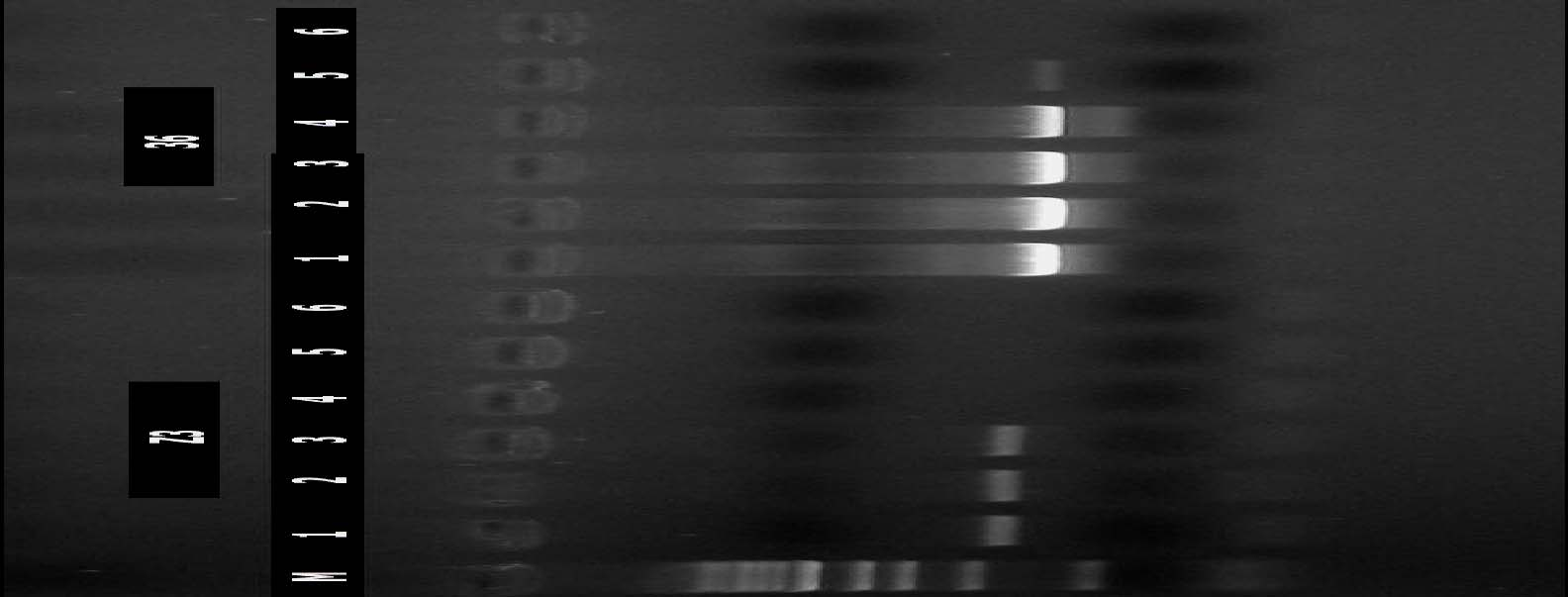 4. BULGULAR Gazi Üniversitesi Hastanesi, Klinik Mikrobiyoloji Laboratuvarından sağlanan 1112 E. coli izolatından çift disk sinerji yöntemine göre GSBL (+) 156 E. coli izolatı çalışmaya alınmış.