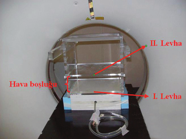 Radyoterapide kullanılan immobilizasyon Şekil 1. Çalışmada kullanılan eğik meme sabitleyicisi. A: Eğik arka destek bölgesi, B: Taban.