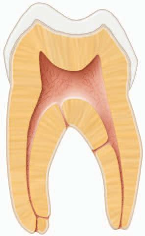 çürükler ve restorasyonların varlığı, abrazyon, erozyon, atrizyon, travma, okluzyon, sistemik hastalıklar ve belli beslenme alışkanlıkları gibi etkenler de reperatif dentin oluşumunu uyararak pulpa