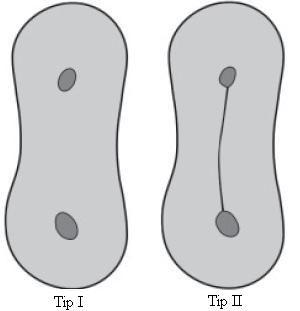 Tip I Tip II Tip III Tip IV Tip V Şekil 1.4. İstmus tiplerinin Hsu ve Kim e göre sınıflandırılması (29).