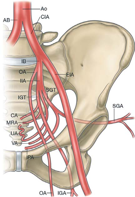 Bölüm 30 EMBOLİZASYON K. Choji, T. Shimizu M. T. Canda, N. Demir Şekil 1: Doğum kanalı ve uterusa giden arterlerin damar şablonları. (a) Dallanmanın en sık görülen şablonu.