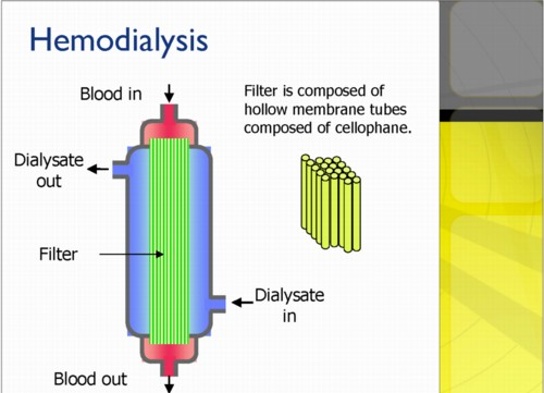 Dializde, kan yarı geçirgen özellikteki selofandan yapılmış bir boru sistemine pompalanır. Bu boru sistemi dializ sıvısı denilen ve kanın normal elektrolitlerini içeren bir sıvı içinde bulunur.