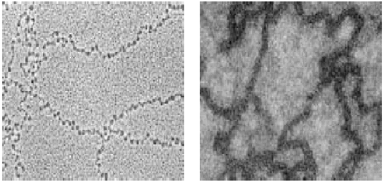 10 nm nucleosom 30 nm nucleosom