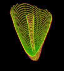 , Micro-CT evaluation of dentine defect formation during re-treatment with hand rotary