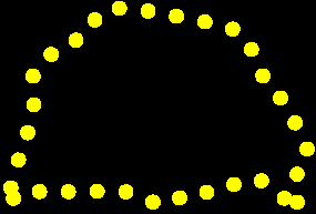 alveolar arkuslar (gingiva) Dilin 2/3 ön