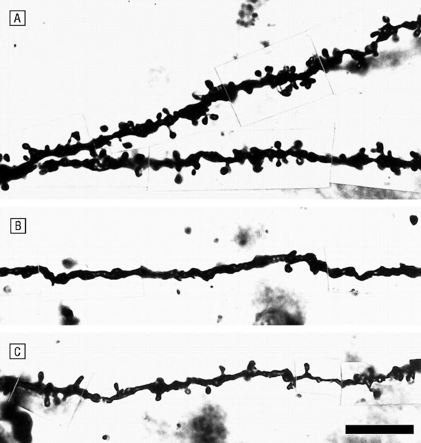 Dorsolateral prefrontal korteks katmanındaki spinleri ve Golgi-doldurulmuş bazilar dendritleri gösteren Brightfield mikrografi fotoğrafları