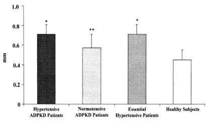 Otozomal Dominant Polikistik Böbrek Hastalığında Hipertansiyon ve Hedef Organ Hasarı P<0.001 1 2 *P < 0.01 vs. Normotensive ADPKD Patients and Healthy Subjects ** P < 0.