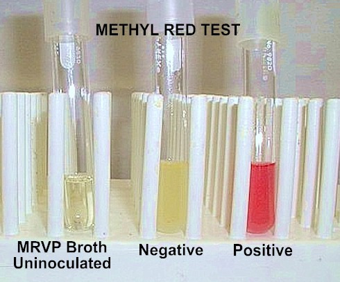 19 Metil Kırmızısı Testi: Bu test, glikozun fermentatif metabolize olması sonucu besi