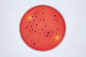 Test strains Growth Colony color Salmonella typhimurium ATCC 14028 good / very good black center Salmonella enteritidis ATCC 13076 good / very good black center Salmonella anatum ATCC 9270 good /