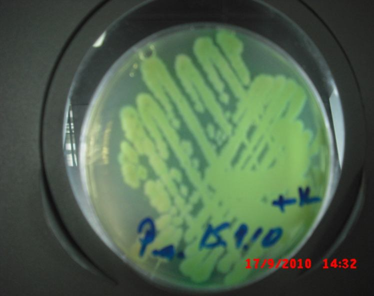 coli ve C.albicans, P.