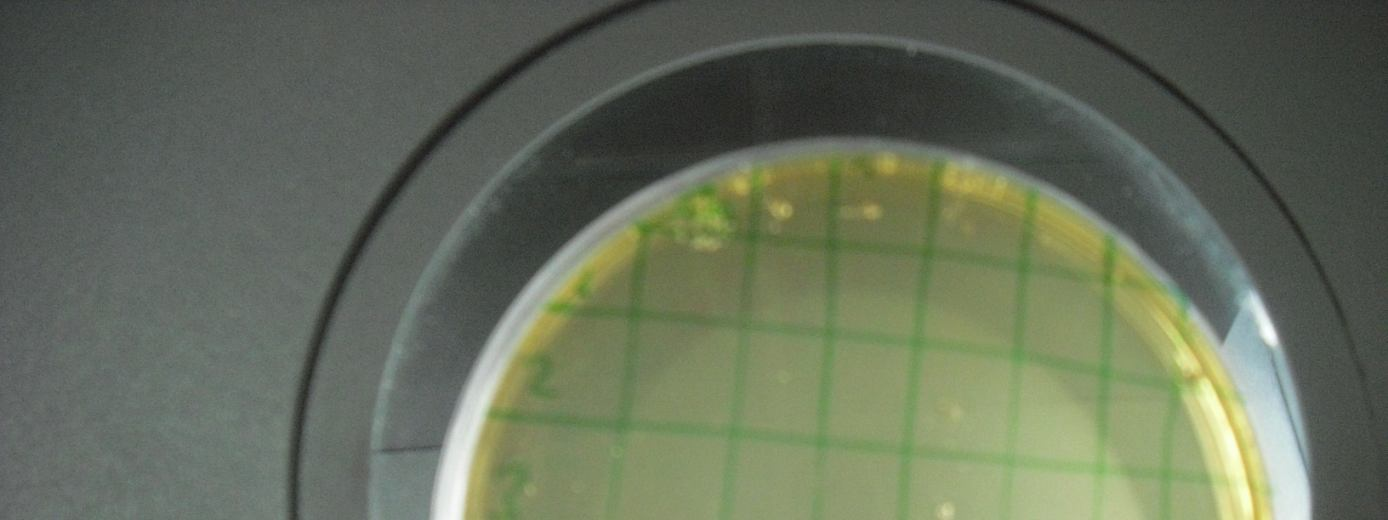 saat sonrasındaki resimleri verilmiştir. P.aeroginosa Candida albicans E.coli S.