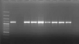 B. Moleküler Analiz (PCR) bulguları: Bu