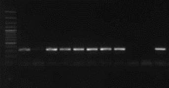 cnf1 genine ait PCR bulguları Şekil 4.