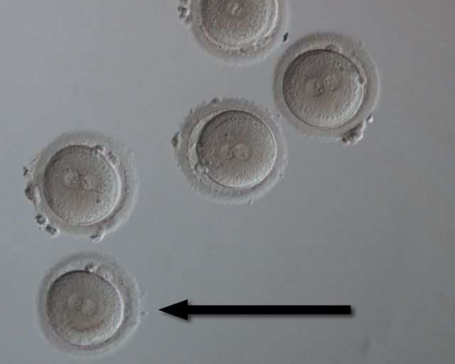 Şekil-3: Fertilize olmuş oositler (pronukleuslar merkezde izleniyor) Embriyonun ikinci ve üçüncü bölünmeleri arasında (dört blastomerli evreden sekiz blastomerli evreye geçiş) maternal genden