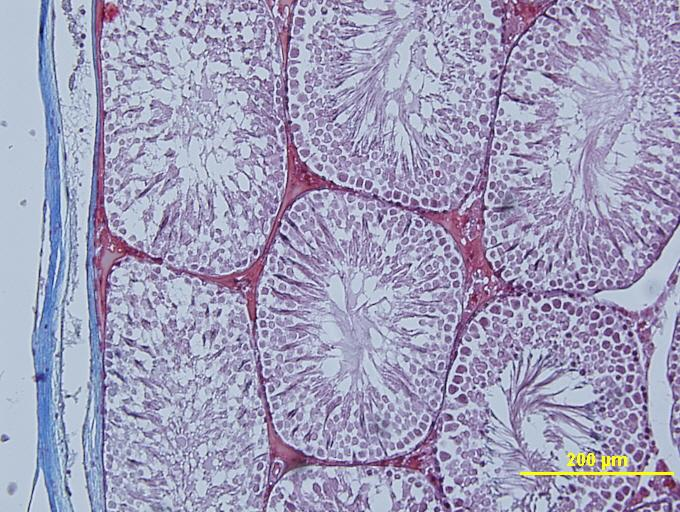 Mavi ok: spermatogonium A, siyah ok: spermatagonium