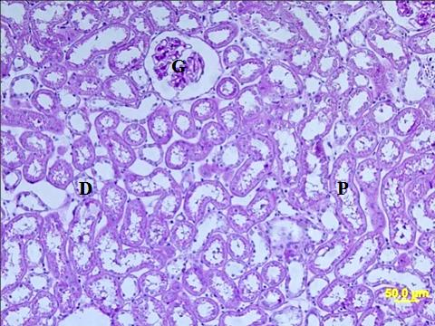 tübüller (P), distal tübüller