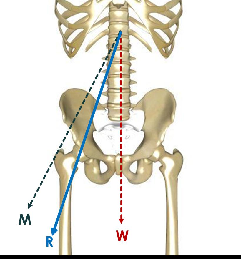 KALÇA BİYOMEKANİĞİ Yürümenin STANS (temas) periyodunda; Vücut ağırlık çizgisinin femur başı rotasyon merkezine uzaklığı,