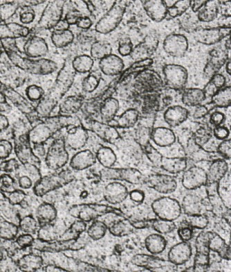 membranlarının bir kısmına ribozomlar bağlanmıştır. Granüllü E.