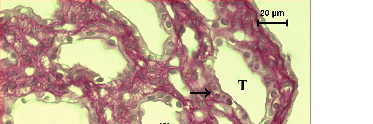 membranları, H: Henle Kulpu, PAS.