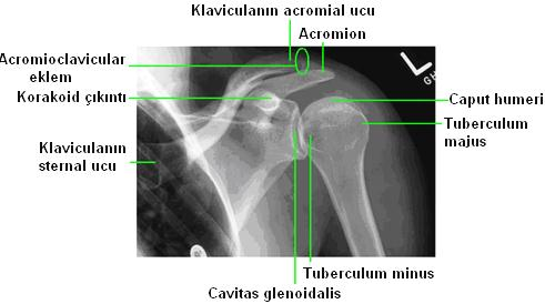 Omuz Ġnternal Rotasyon Radyografisinde Anatomik Yapı