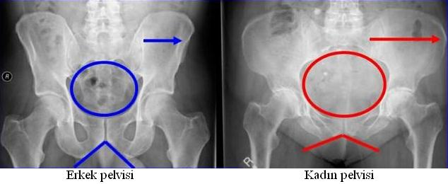 2.1.2. Serbest Alt Taraf Kemikleri Resim 2.5: Erkek ve kadın pelvisi radyogramı (A. P) Serbest alt taraf kemikleri uyluk, bacak, ayak kemikleri olarak üç bölümde incelenir. 2.1.2.1. Uyluk Kemiği Kalça eklemi ile diz arasına uyluk iskeleti denir.