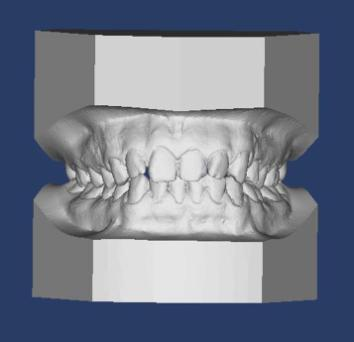 düzenekler de bulunmalıdır. 28 Ortodontik Model Kesimi 1) İlk olarak alt çene modelinin alt yüzeyi, oklüzal düzleme paralel olarak kesilir.