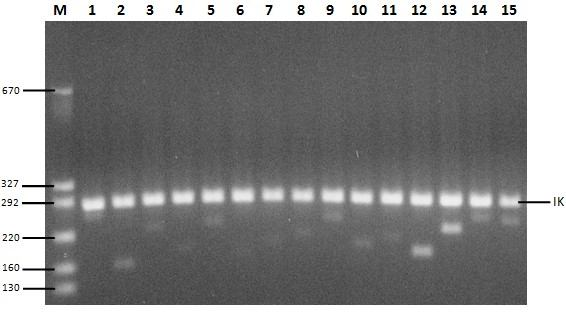 Şekil 4.22 de tüm genlerin M. tuberculosis H37Rv ATCC 25618 suşundaki PZR fotoğrafı 